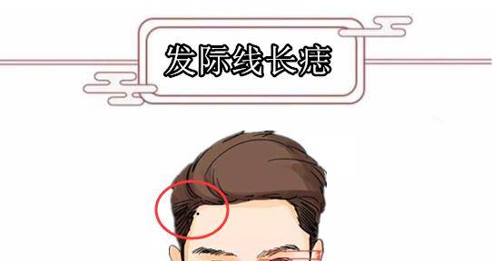 发际线长痣在相学当中,发际线的左右两边的位置,属于父母宫,代表的是