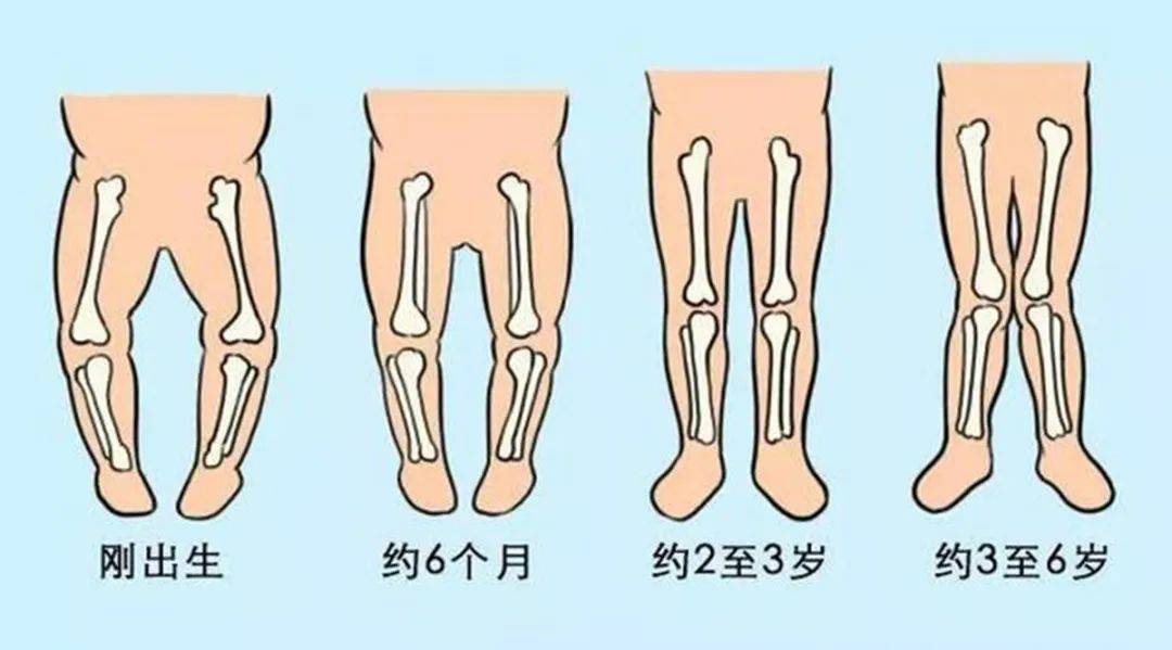 原创三种行为可能会影响宝宝腿型发育,家长不当回事,宝宝会遭罪