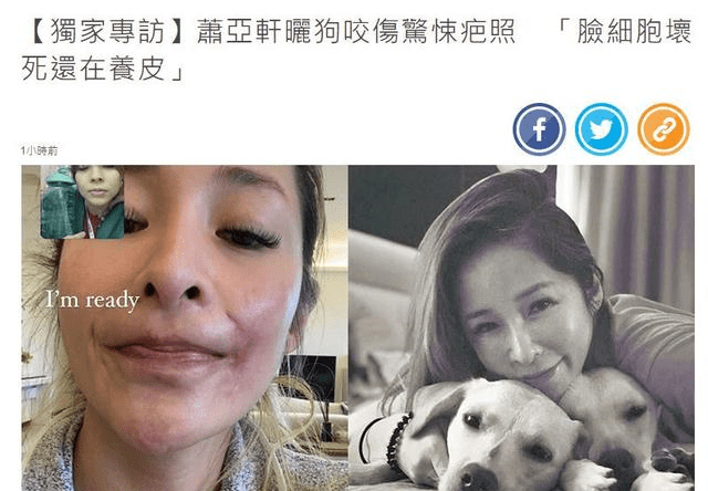 女明星被狗咬伤,两月后拍照曝脸部长长的疤痕,网友看了太心疼!