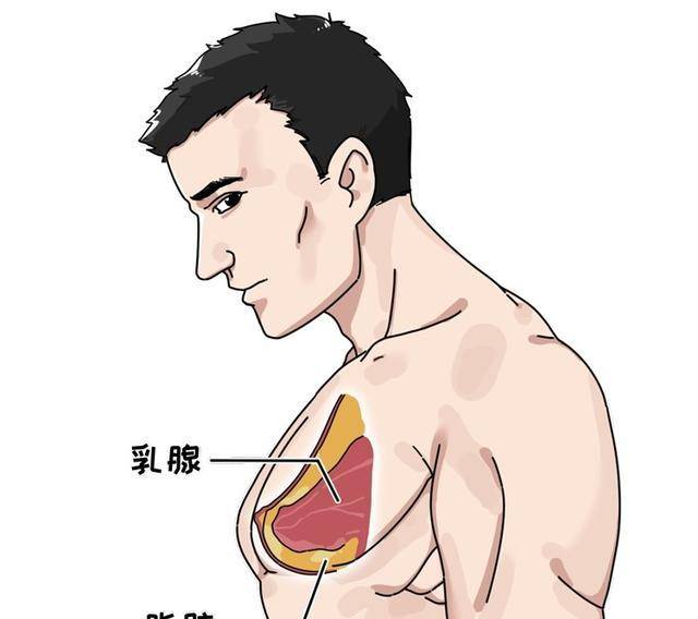 男性乳房发育