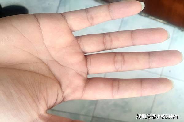 中风后,用针扎手指放血,可以起到唤醒和急救的作用,是