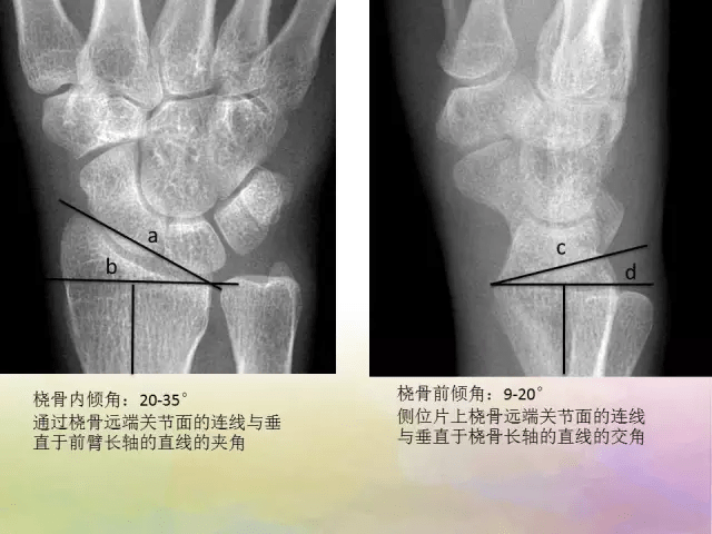 基础学习腕关节解剖详解