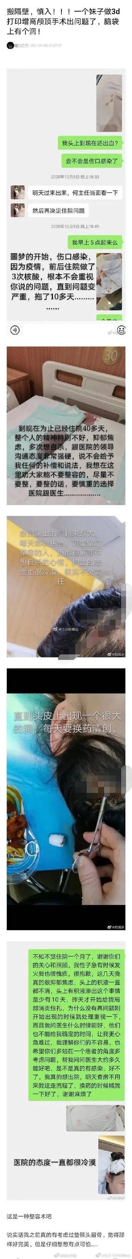 割阴挑筋断骨切胃那些为了美不要命的女人到底有多可怕