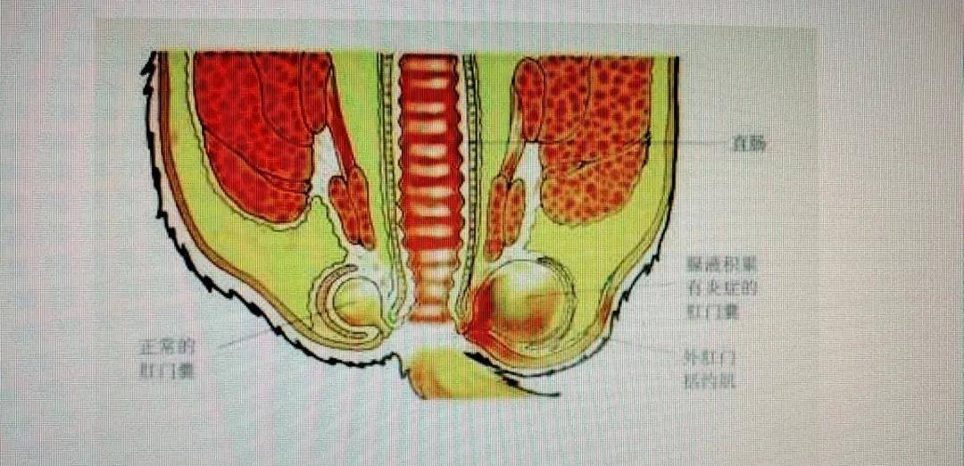 过来人告诉你,这么做保证有效_肛门