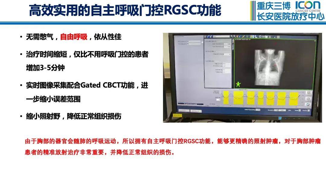 胸部肿瘤会运动,首选带自主呼吸门控系统的放疗很关键!