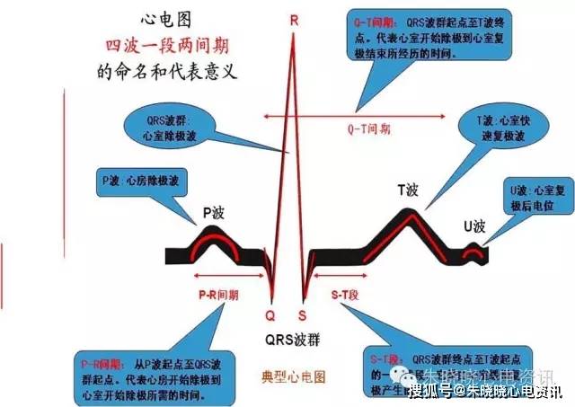 临床实用心电图入门系列之二:心电图导联,波形及临床价值