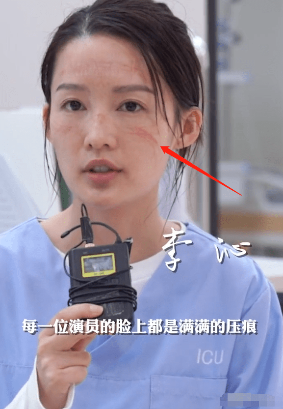 身穿护士服素颜出镜,脸上满是口罩压痕?