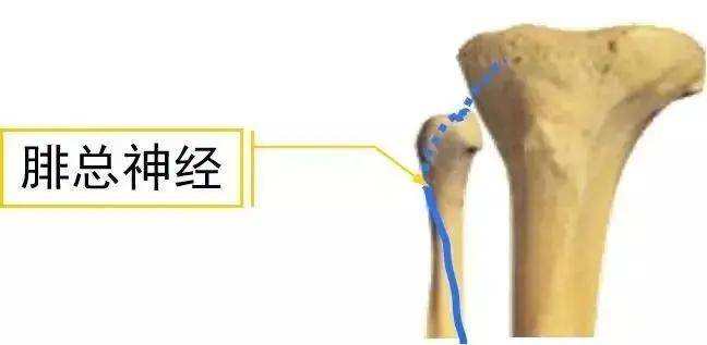 腓总神经损伤的确诊方法及治疗方式?