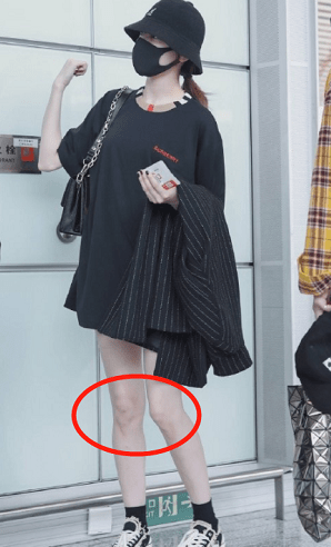 迪丽热巴有漫画腿为何不穿短裙?看到她膝盖那刻,网友