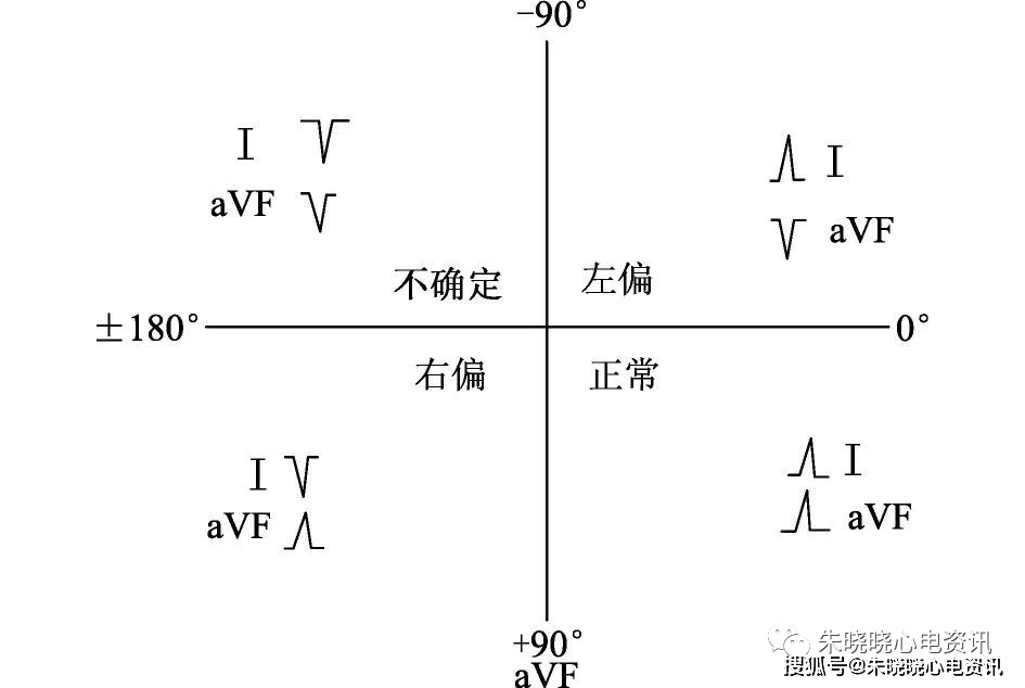 心电图测量技术指南