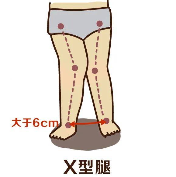 想要宝宝腿型发育好,应该注意些什么?