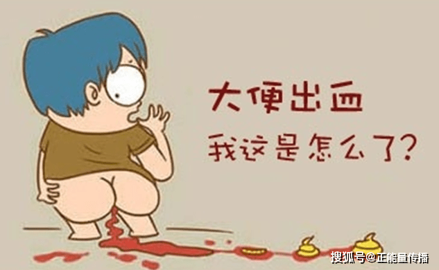 大便出现三种"特征",暗示肠癌"已登门"?