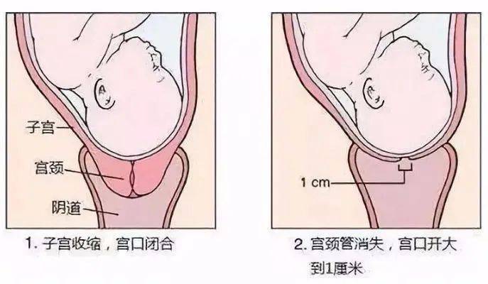 月经少与生孩子有关吗宫颈管多长正常