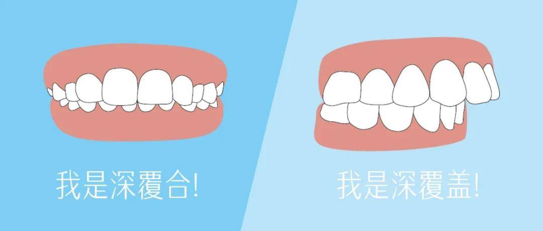 牙齿深覆合vs牙齿深覆盖,一字之差,区别在哪里?