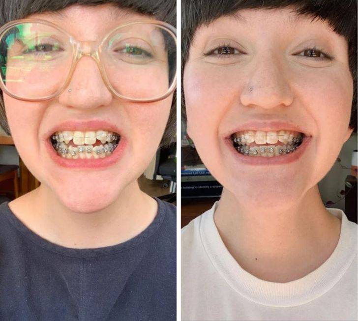 15张照片证明任何人的牙齿都可以变成完美的微笑