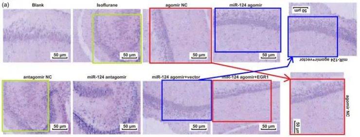 4b 尼氏染色后观察到的海马ca1区神经元和尼氏小体(在重新缩放和
