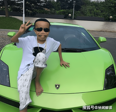 丑男陈山的网红史:36名女友72台豪车,23岁身价10亿