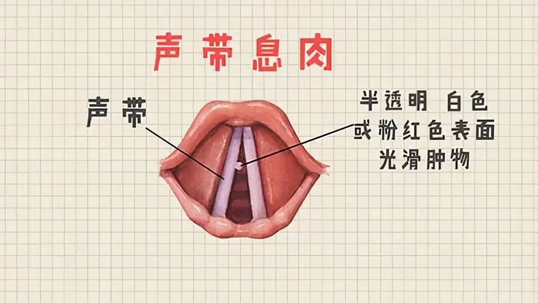 生命不息息息不止息肉的自白书