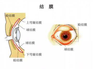 立秋后眼睛红肿痒专家提醒注意预防过敏性结膜炎