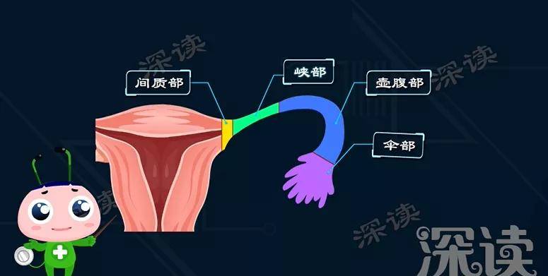 盆腔炎是如何一步步致不孕的_输卵管