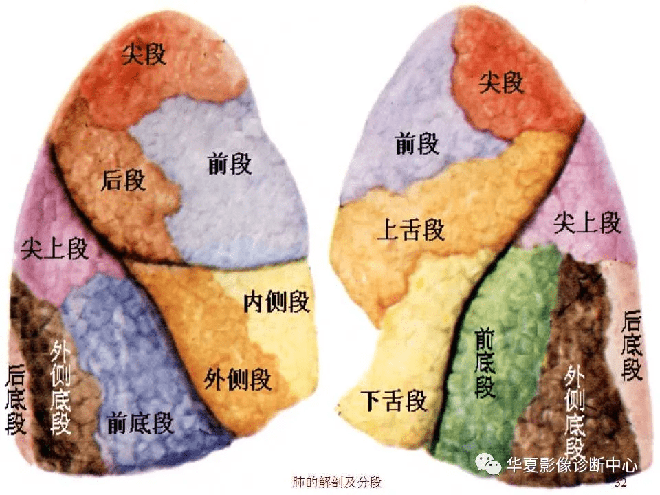 超详尽的心脏大血管影像示意图及肺部解剖与影像