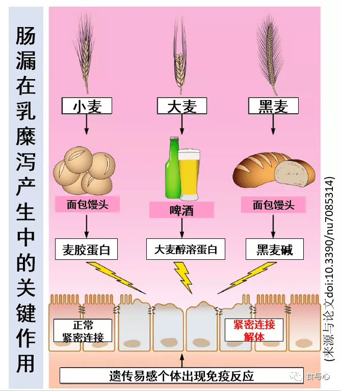 在美国,约有1%的人患有乳糜泻 celiac disease,这是一种严重的肠漏