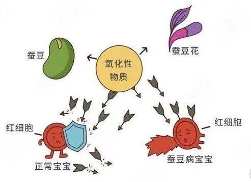 吃蚕豆脸变黄小儿蚕豆病咋预防