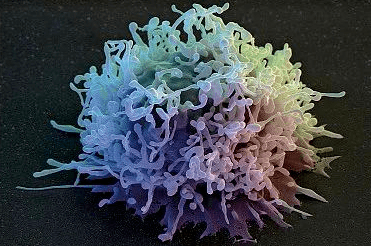 nk细胞,也称自然杀伤细胞(natural killer cell),来源于骨髓淋巴样干
