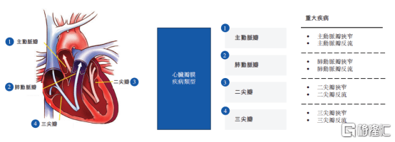 二尖瓣反流发病率上涨,推动介入治疗需求 心脏瓣膜病作为我国一种