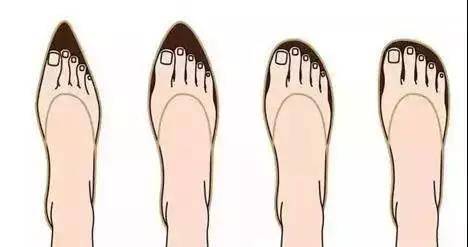 女性患者如果某些场合必须穿高跟鞋,应选择高度不超过4厘米的鞋子.