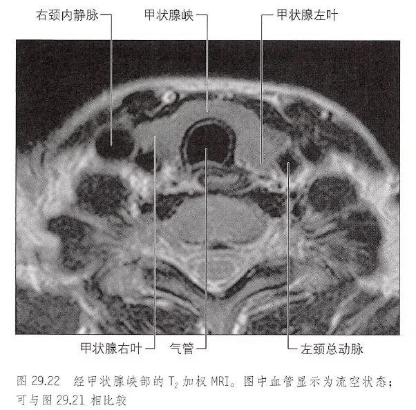 解剖丨颈部,颅面骨~_传播_公益_目的