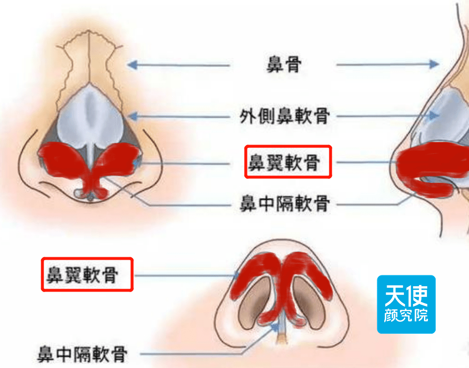 但在聊之前,先带大家认识一个部位——鼻翼软骨.