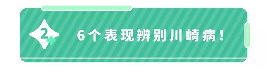 儿科医生都怕的「川崎病」,究竟有多要命？可能击垮一个家！