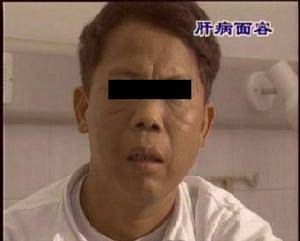 肝脏的天然良药找到了保温杯里常泡点排肝毒壮肝阳