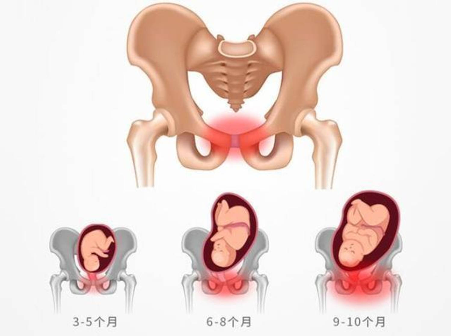 生娃后的＂妈妈胯＂,成了宝妈难说的痛,骨盆恢复怎么破