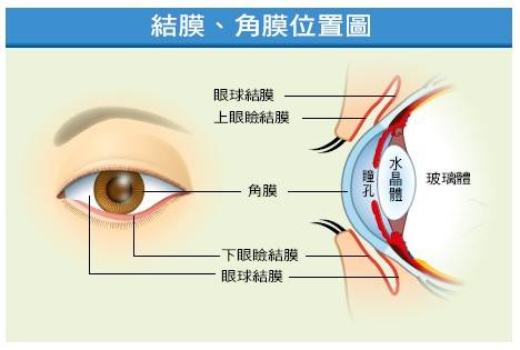 眼睛的结膜和角膜位置图我们的眼睛内部充满了大量的凝胶状物体和