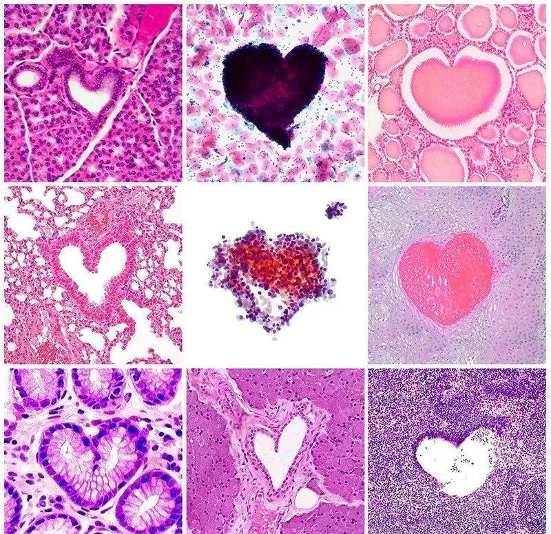病理艺术 love under the microscope_生产_企业_服务