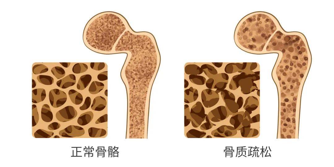 快转给爸妈一文带你读懂健康骨骼核心信息