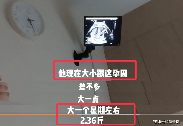 也就是说,现在苗苗怀孕27周,按这个来算,苗苗的预产期大约是在7月的