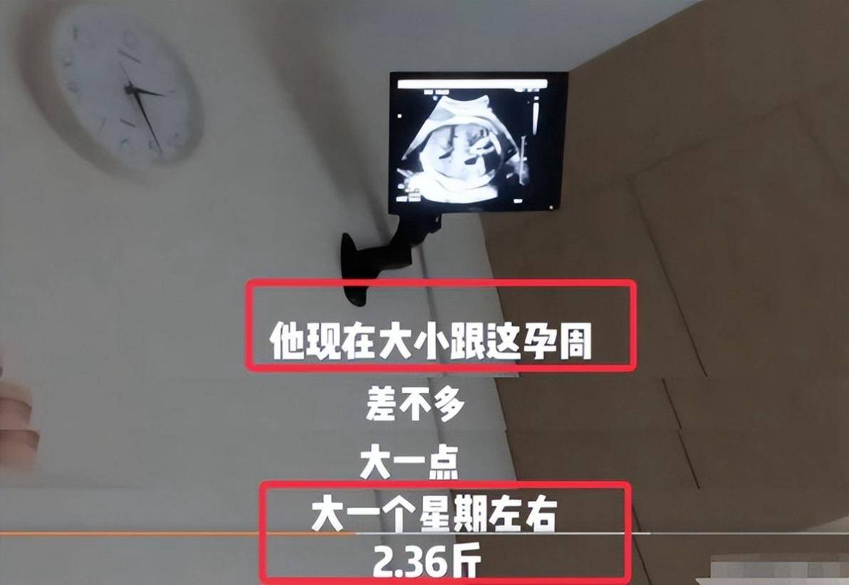 苗苗怀二胎,宝宝的性别成焦点,关于生男生女那些谣言,你信了吗