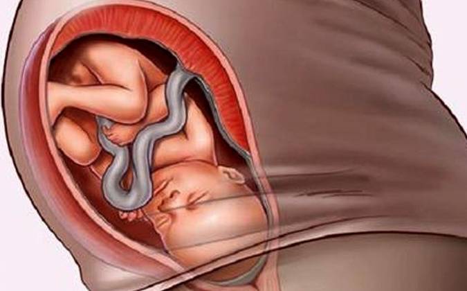 大约到了怀孕的34周左右,胎儿在子宫内的胎位就已经固定了,这个时候