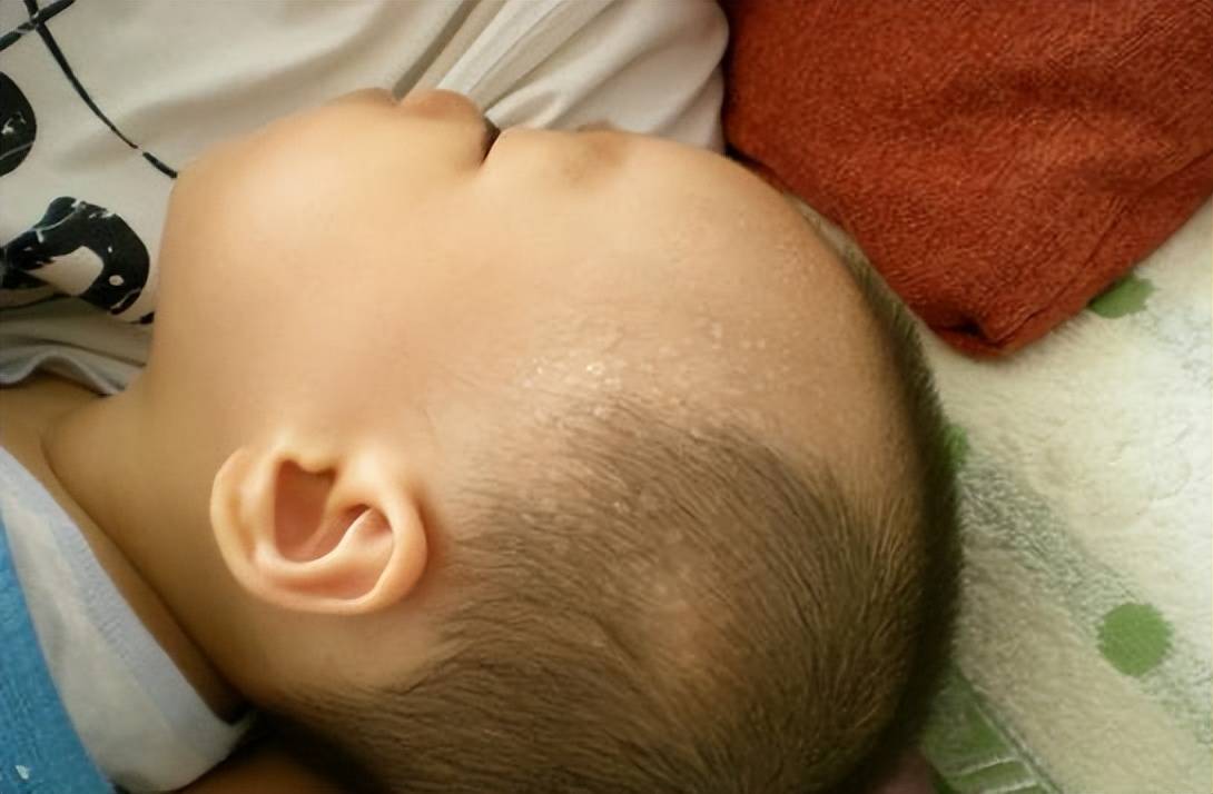家有＂蒸笼娃＂：宝宝睡觉后脑勺总湿漉漉的,出汗原因家长要知晓