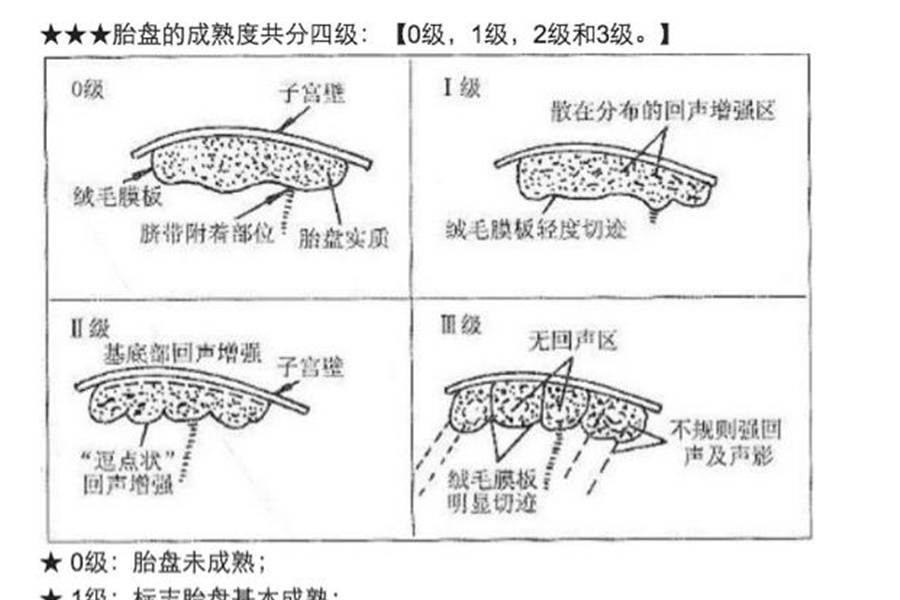 原创孕期的超声检查报告单中都有啥若能看懂也就安心多了