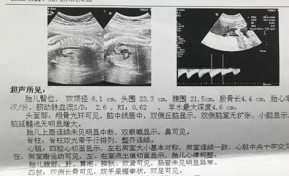 三维彩超出具的b超单是黑白的,上面几个演示图只是孩子身体的某一个