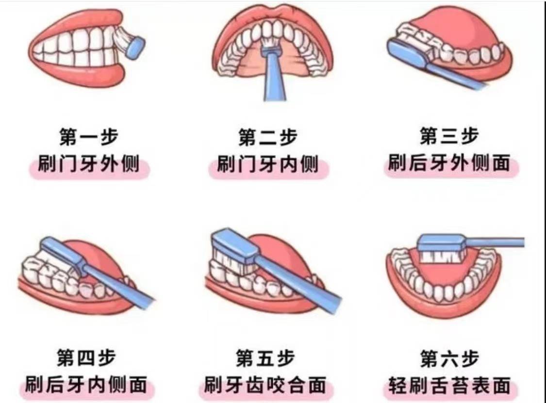 去烟渍必需洗牙吗？口腔专业人士收你几招，居家就能搞定满嘴烟渍！