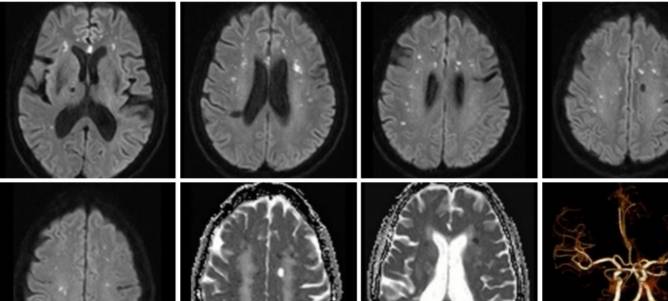 �Լ����没���͹�ע�Թ��������׶������ۺ���ح3���Ӷ�Ƭ ...