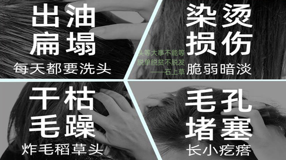 头发出油掉发严重用什么洗发水？从此不做秃头小姐妹!