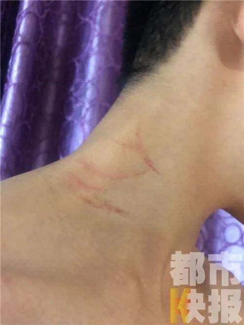 者姓魏,是潼关县一高中教师,两名孩子脖子,胳膊多处受伤,有明显的抓痕