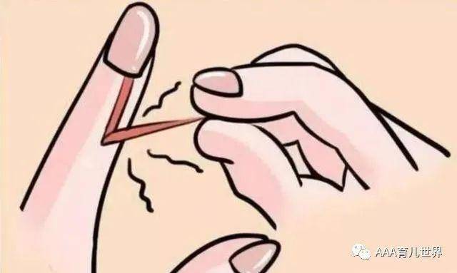 [孩子]是缺乏维生素？3个原因，大多数家长都不知道宝宝手上总长倒刺