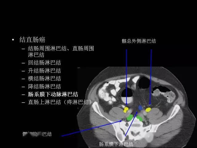 收藏全腹部高清ct图谱淋巴结彩色图谱血管解剖图谱大汇总